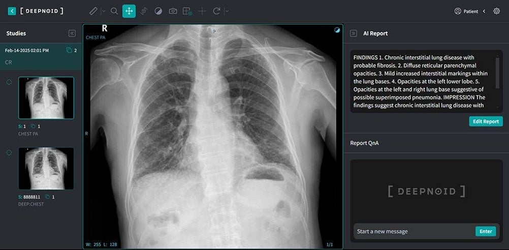 DEEPNOID、FuriosaAIのNPU導入へ　運用コスト最適化に期待 - 画像2