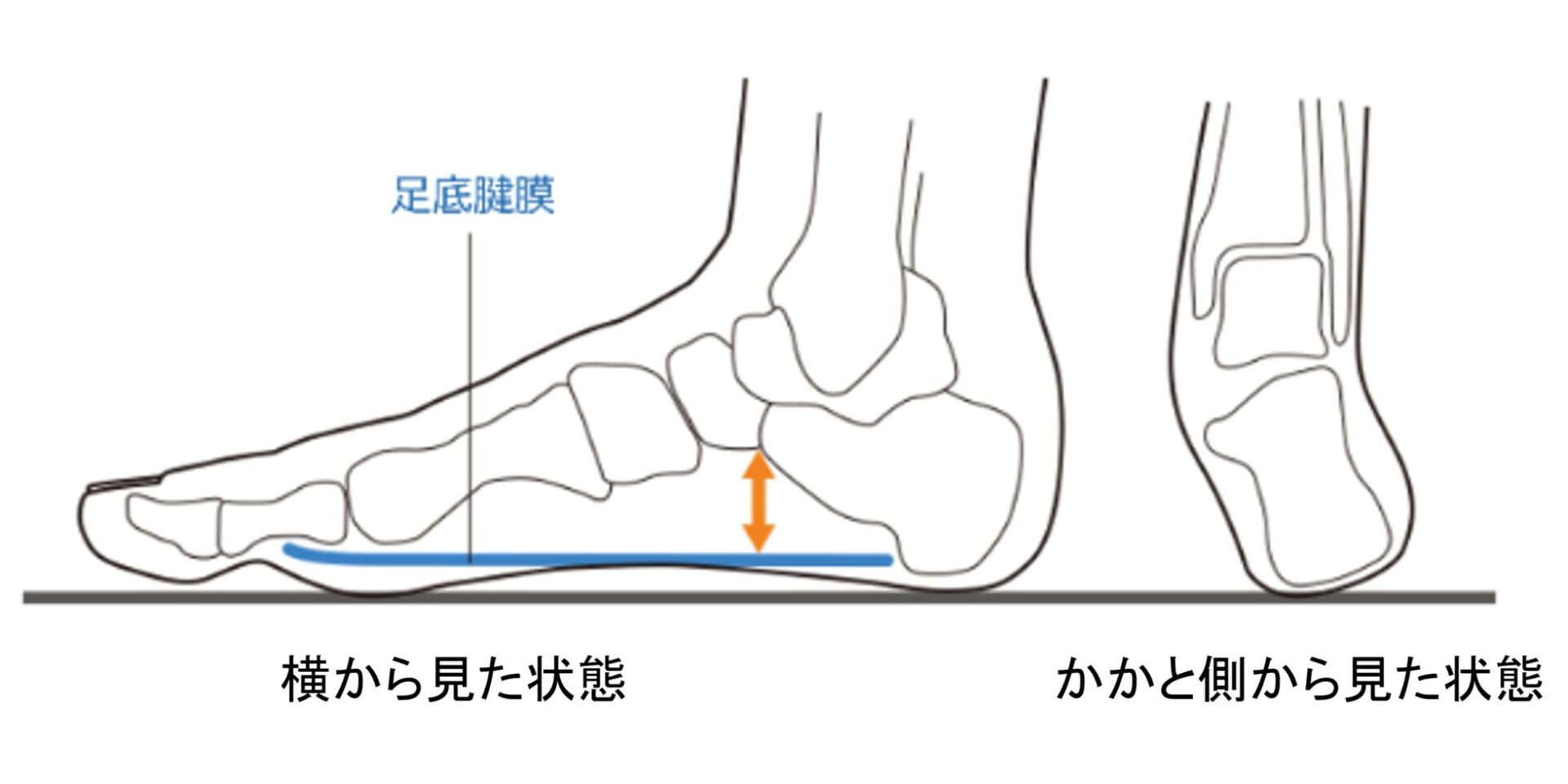 トヨタバッテリー、製造現場の足の負担軽減に「メディエイド」インソールを導入 - 画像18