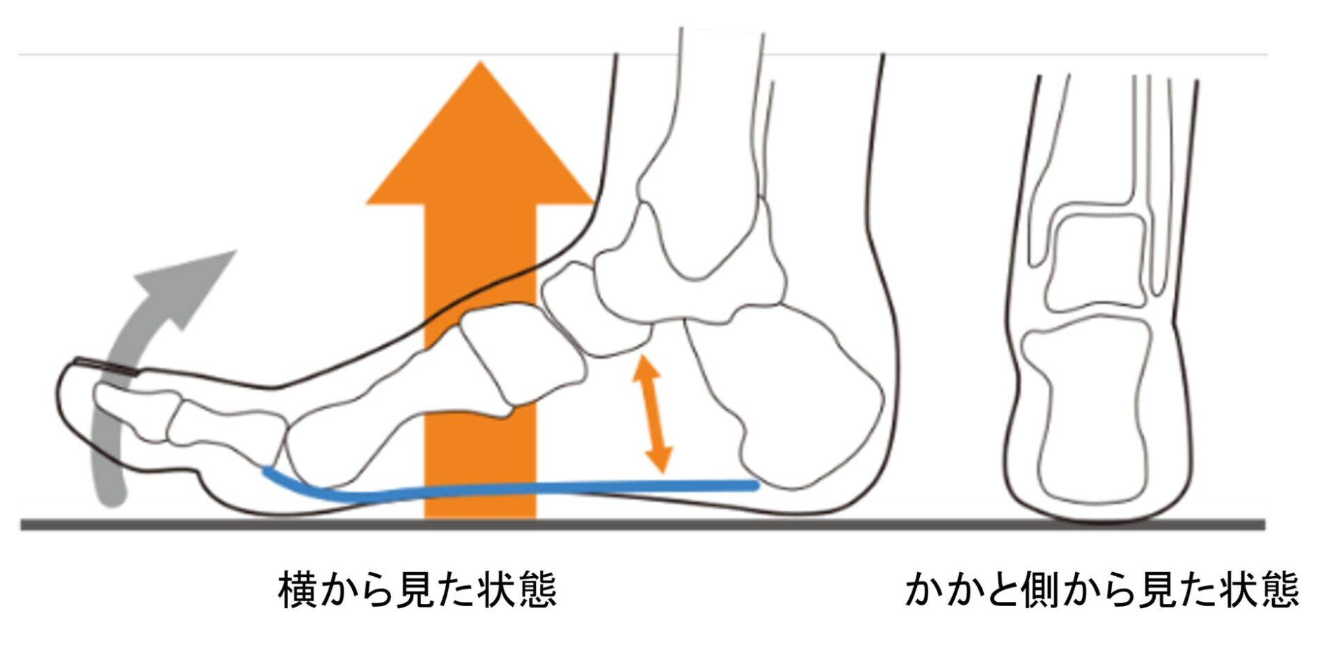 トヨタバッテリー、製造現場の足の負担軽減に「メディエイド」インソールを導入 - 画像19