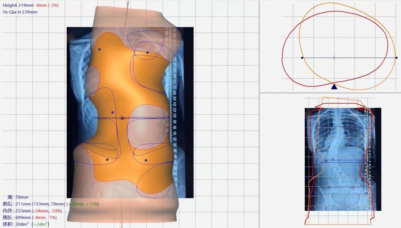 Revopoint、3D技術で未来創造へ 文化財・医療分野で展開 - 画像5